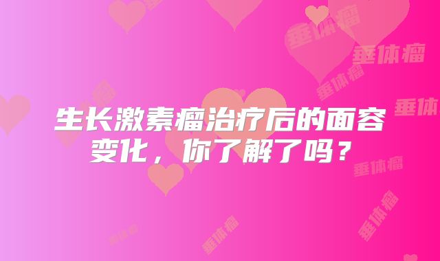 生长激素瘤治疗后的面容变化，你了解了吗？