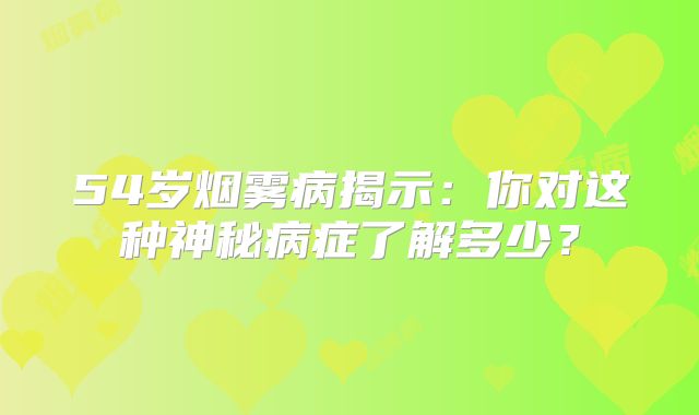 54岁烟雾病揭示：你对这种神秘病症了解多少？