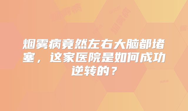 烟雾病竟然左右大脑都堵塞，这家医院是如何成功逆转的？
