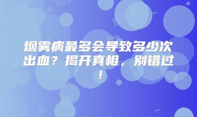 烟雾病最多会导致多少次出血？揭开真相，别错过！