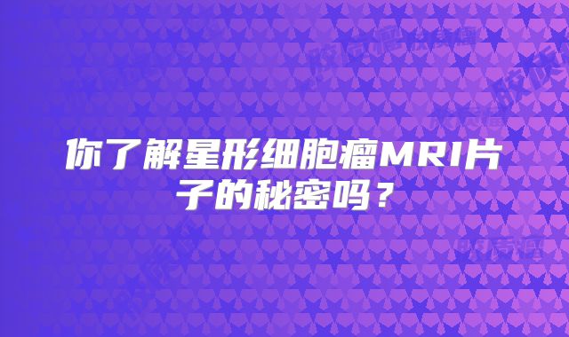 你了解星形细胞瘤MRI片子的秘密吗？