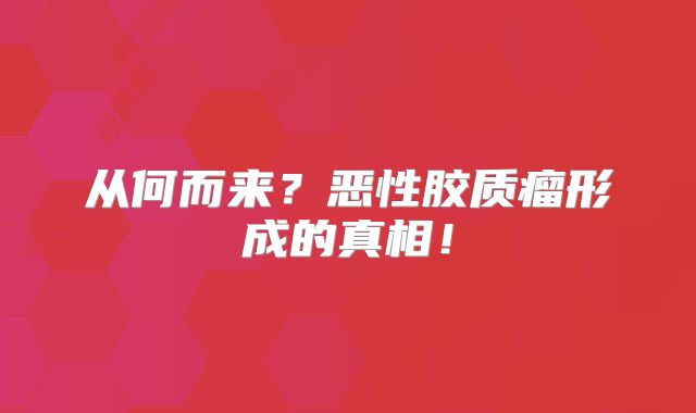 从何而来？恶性胶质瘤形成的真相！