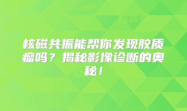 核磁共振能帮你发现胶质瘤吗？揭秘影像诊断的奥秘！