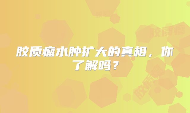 胶质瘤水肿扩大的真相，你了解吗？
