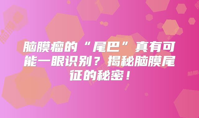 脑膜瘤的“尾巴”真有可能一眼识别？揭秘脑膜尾征的秘密！
