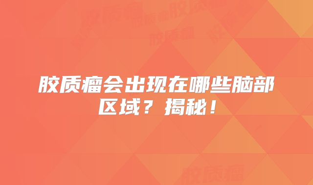胶质瘤会出现在哪些脑部区域？揭秘！