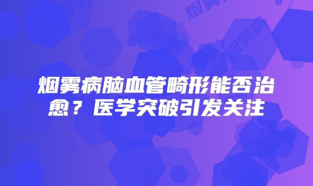 烟雾病脑血管畸形能否治愈？医学突破引发关注
