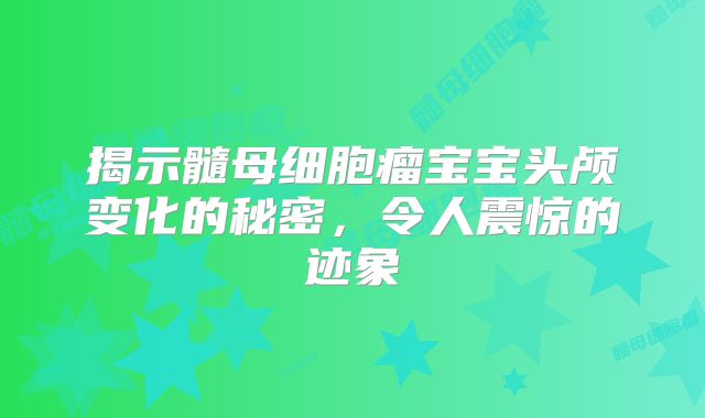 揭示髓母细胞瘤宝宝头颅变化的秘密，令人震惊的迹象