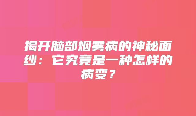 揭开脑部烟雾病的神秘面纱：它究竟是一种怎样的病变？