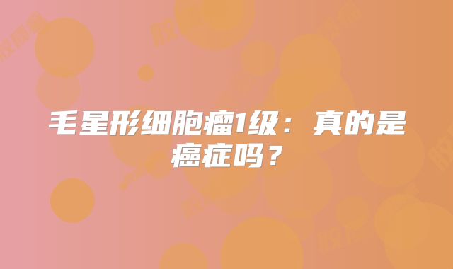 毛星形细胞瘤1级：真的是癌症吗？