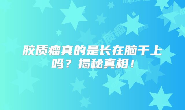 胶质瘤真的是长在脑干上吗？揭秘真相！