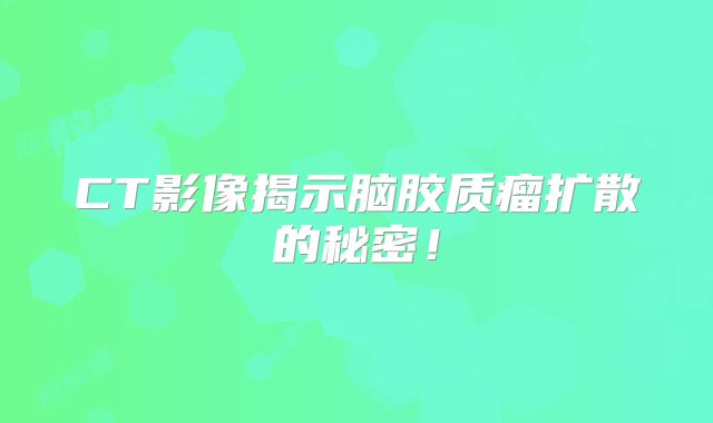 CT影像揭示脑胶质瘤扩散的秘密！