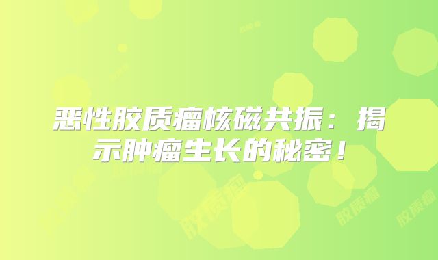 恶性胶质瘤核磁共振：揭示肿瘤生长的秘密！