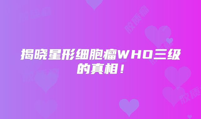 揭晓星形细胞瘤WHO三级的真相！