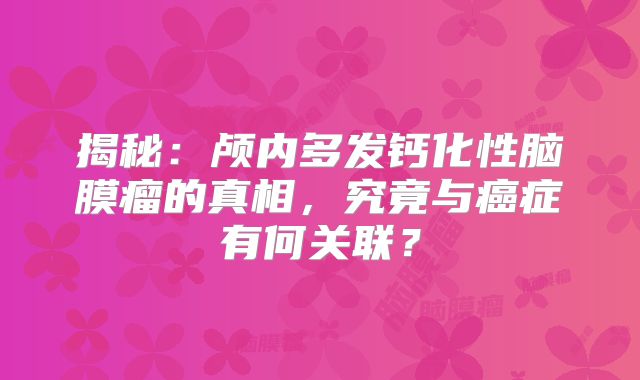 揭秘：颅内多发钙化性脑膜瘤的真相，究竟与癌症有何关联？