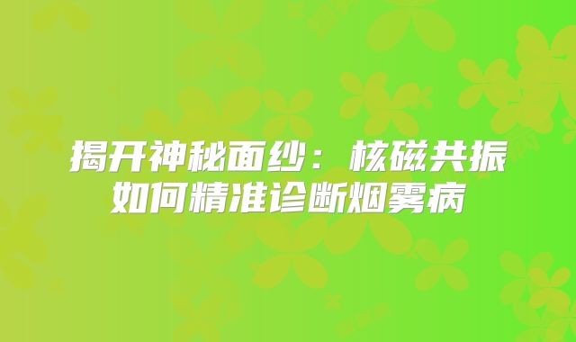 揭开神秘面纱：核磁共振如何精准诊断烟雾病