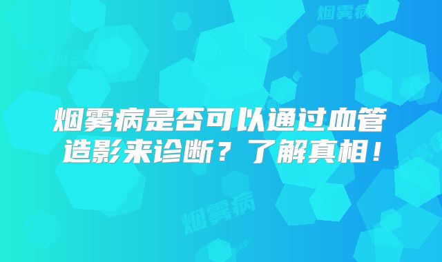 烟雾病是否可以通过血管造影来诊断？了解真相！