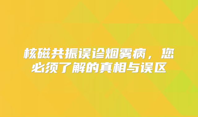核磁共振误诊烟雾病，您必须了解的真相与误区