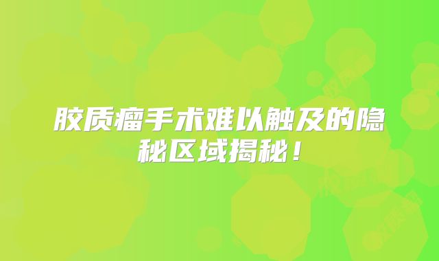 胶质瘤手术难以触及的隐秘区域揭秘！