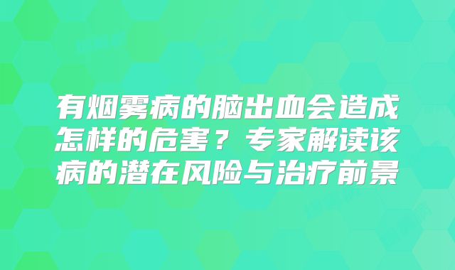 有烟雾病的脑出血会造成怎样的危害？专家解读该病的潜在风险与治疗前景