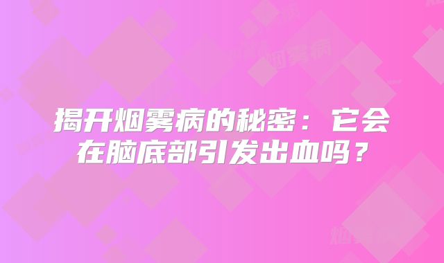 揭开烟雾病的秘密：它会在脑底部引发出血吗？