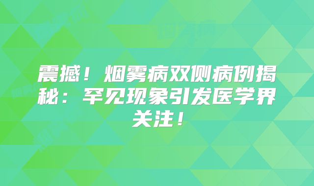 震撼！烟雾病双侧病例揭秘：罕见现象引发医学界关注！