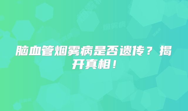 脑血管烟雾病是否遗传？揭开真相！