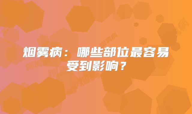 烟雾病：哪些部位最容易受到影响？