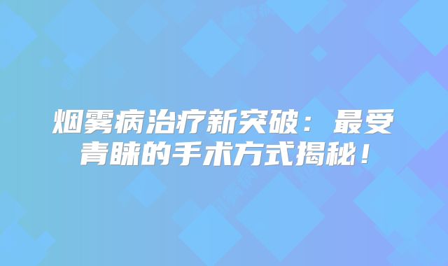 烟雾病治疗新突破：最受青睐的手术方式揭秘！