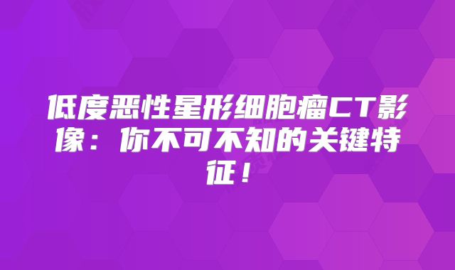 低度恶性星形细胞瘤CT影像：你不可不知的关键特征！
