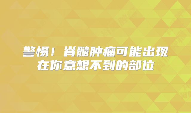 警惕！脊髓肿瘤可能出现在你意想不到的部位