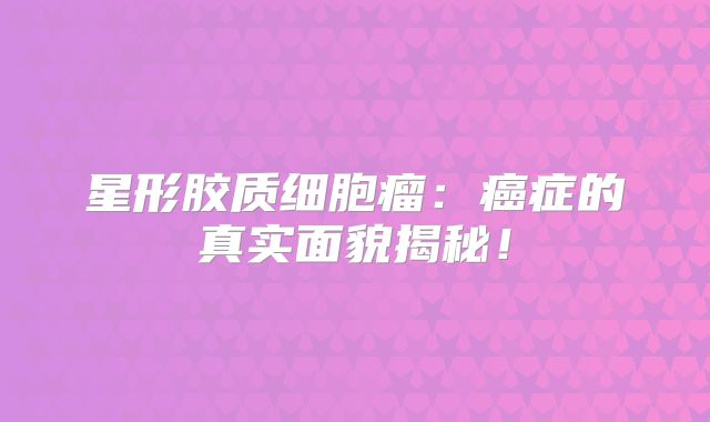 星形胶质细胞瘤：癌症的真实面貌揭秘！