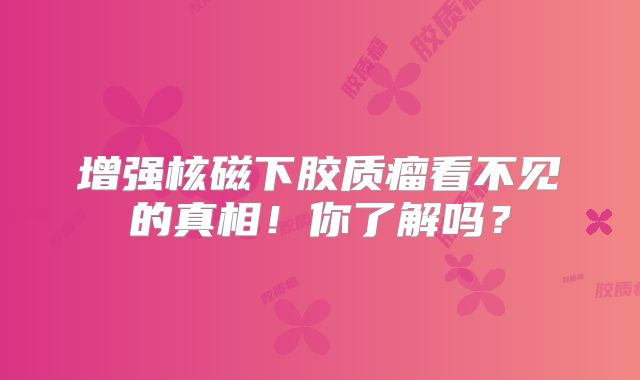 增强核磁下胶质瘤看不见的真相！你了解吗？