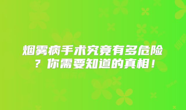 烟雾病手术究竟有多危险？你需要知道的真相！