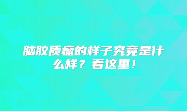 脑胶质瘤的样子究竟是什么样？看这里！