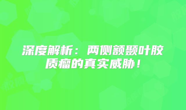 深度解析：两侧额颞叶胶质瘤的真实威胁！