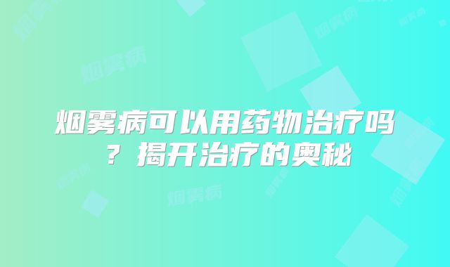 烟雾病可以用药物治疗吗？揭开治疗的奥秘