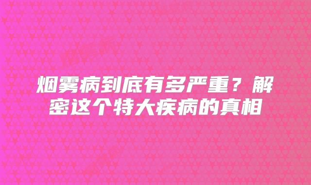烟雾病到底有多严重？解密这个特大疾病的真相