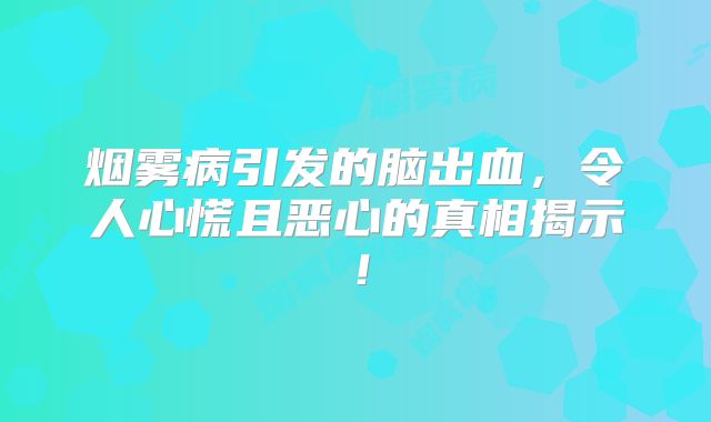 烟雾病引发的脑出血，令人心慌且恶心的真相揭示！