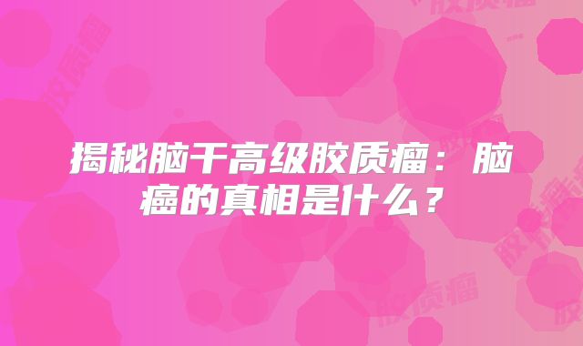 揭秘脑干高级胶质瘤：脑癌的真相是什么？