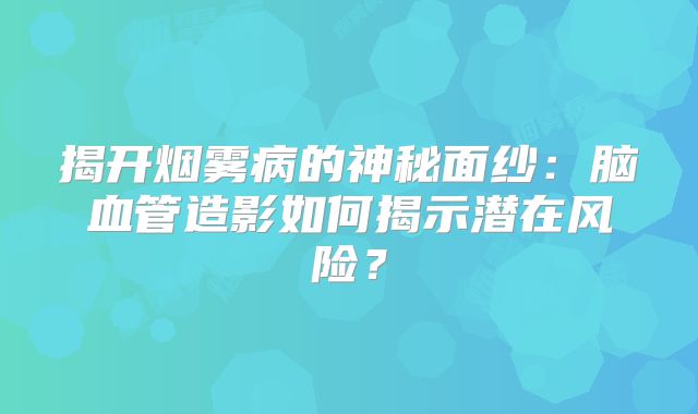 揭开烟雾病的神秘面纱：脑血管造影如何揭示潜在风险？