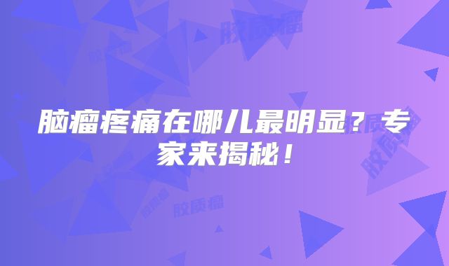 脑瘤疼痛在哪儿最明显？专家来揭秘！