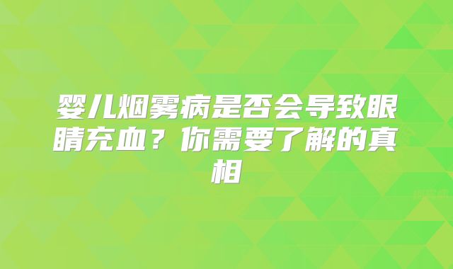 婴儿烟雾病是否会导致眼睛充血？你需要了解的真相