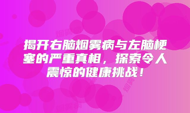 揭开右脑烟雾病与左脑梗塞的严重真相，探索令人震惊的健康挑战！