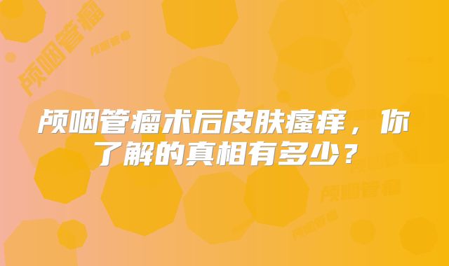 颅咽管瘤术后皮肤瘙痒，你了解的真相有多少？