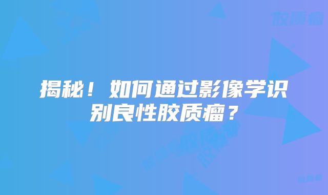 揭秘！如何通过影像学识别良性胶质瘤？