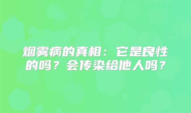 烟雾病的真相：它是良性的吗？会传染给他人吗？