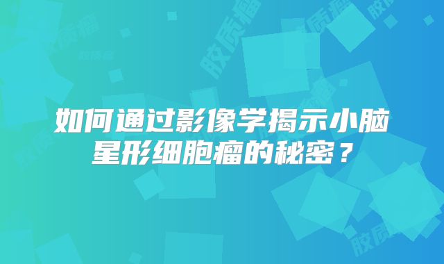 如何通过影像学揭示小脑星形细胞瘤的秘密？