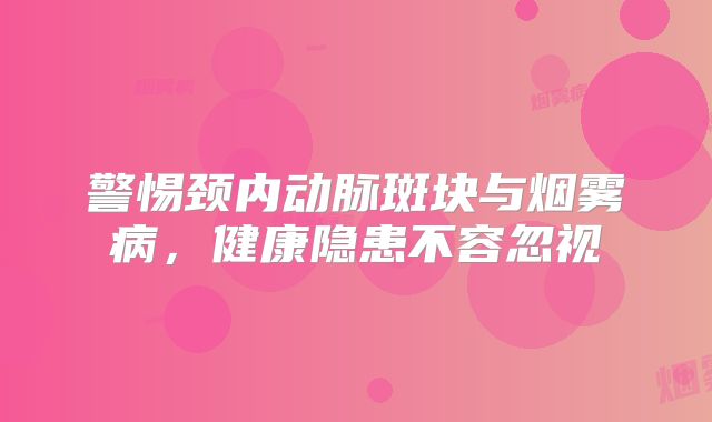 警惕颈内动脉斑块与烟雾病，健康隐患不容忽视