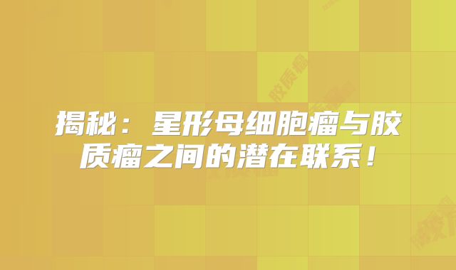 揭秘：星形母细胞瘤与胶质瘤之间的潜在联系！